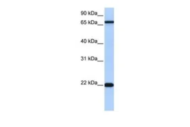 Anti-ACCSL antibody, N-term used in Western Blot (WB). GTX46219