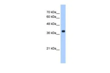 Anti-FNTA antibody, C-term used in Western Blot (WB). GTX46222