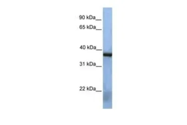 Anti-NAT12 antibody, Internal used in Western Blot (WB). GTX46225