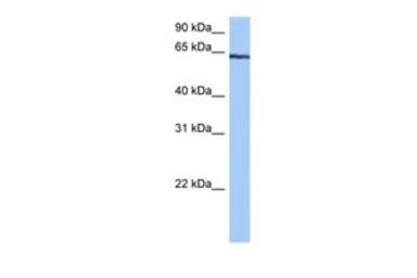Anti-TTC6 antibody, C-term used in Western Blot (WB). GTX46227