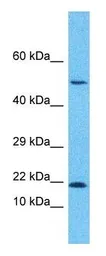 Anti-GADD45B antibody, Internal used in Western Blot (WB). GTX46244