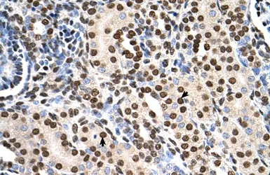 Anti-RSU1 antibody, C-term used in IHC (Paraffin sections) (IHC-P). GTX46246