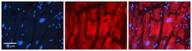 Anti-Pyruvate Dehydrogenase E1 beta subunit antibody, N-term used in IHC (Paraffin sections) (IHC-P). GTX46256
