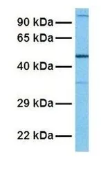 Anti-IL28 Receptor alpha antibody, N-term used in Western Blot (WB). GTX46261