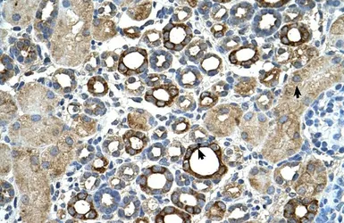 Anti-Matriptase / ST14 antibody used in IHC (Paraffin sections) (IHC-P). GTX46264