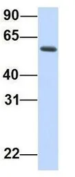 Anti-REC8 antibody, N-term used in Western Blot (WB). GTX46265