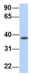 Anti-SRRD antibody, Internal used in Western Blot (WB). GTX46267