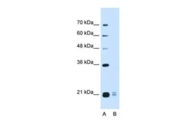 Anti-PLAC1L antibody, Internal used in Western Blot (WB). GTX46276