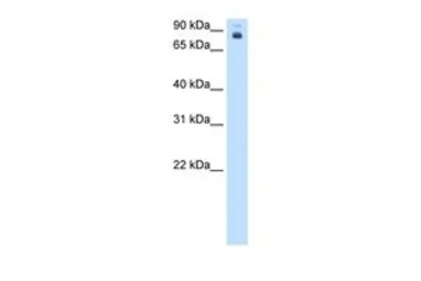 Anti-PB antibody, Internal used in Western Blot (WB). GTX46281