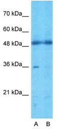 Anti-TMEM30A antibody, Internal used in Western Blot (WB). GTX46298