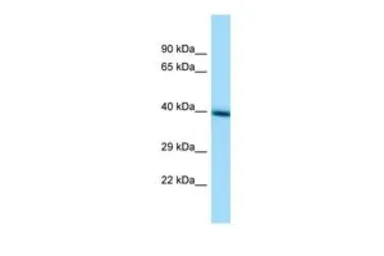 Anti-TMEM30A antibody, Internal used in Western Blot (WB). GTX46298