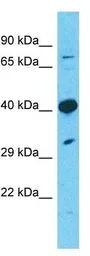 Anti-TMEM30A antibody, Internal used in Western Blot (WB). GTX46298