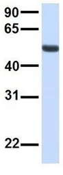 Anti-TMEM57 antibody, N-term used in Western Blot (WB). GTX46302