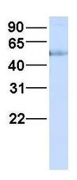 Anti-HHAT antibody, N-term used in Western Blot (WB). GTX46303