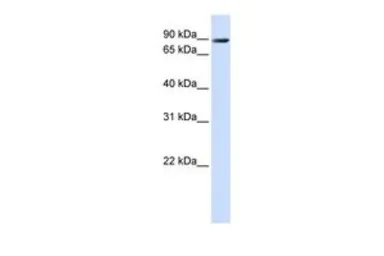Anti-TMEM16K antibody, C-term used in Western Blot (WB). GTX46308
