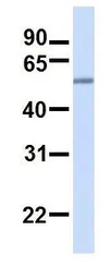 Anti-TMEM16K antibody, C-term used in Western Blot (WB). GTX46308
