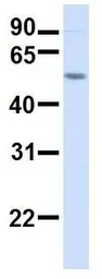 Anti-TMEM16K antibody, C-term used in Western Blot (WB). GTX46308