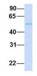 Anti-SUSD4 antibody, N-term used in Western Blot (WB). GTX46312