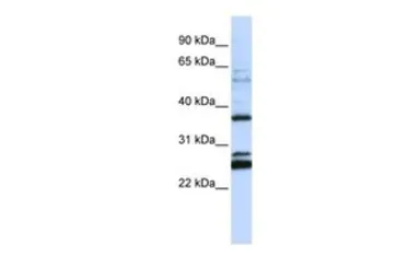 Anti-FAM70A antibody, N-term used in Western Blot (WB). GTX46314
