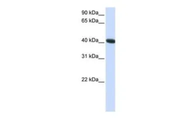 Anti-C1ORF159 antibody, C-term used in Western Blot (WB). GTX46316