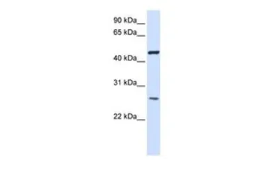 Anti-TMEM127 antibody, Internal used in Western Blot (WB). GTX46321
