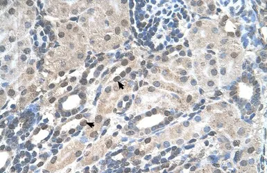 Anti-PIGV antibody, N-term used in IHC (Paraffin sections) (IHC-P). GTX46322
