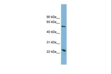 Anti-TMEM161A antibody, Internal used in Western Blot (WB). GTX46324