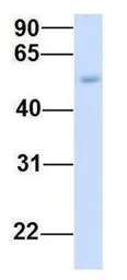 Anti-TMEM161A antibody, Internal used in Western Blot (WB). GTX46324