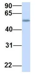Anti-TMEM161A antibody, Internal used in Western Blot (WB). GTX46324