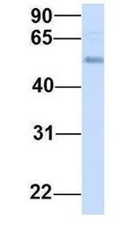 Anti-TMEM161A antibody, Internal used in Western Blot (WB). GTX46324