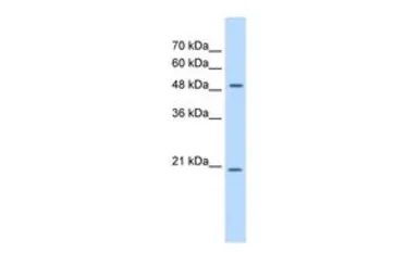 Anti-GCNT4 antibody, C-term used in Western Blot (WB). GTX46337