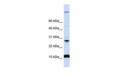 Anti-C19ORF56 antibody, N-term used in Western Blot (WB). GTX46346