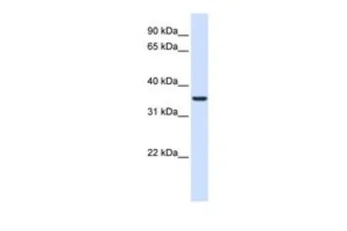 Anti-TXNDC14 antibody, Internal used in Western Blot (WB). GTX46347