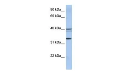 Anti-TEX264 antibody, Internal used in Western Blot (WB). GTX46351