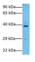 Anti-COQ2 antibody, Internal used in Western Blot (WB). GTX46352