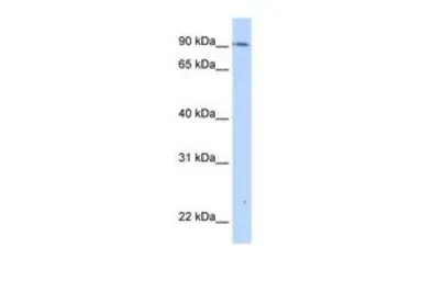 Anti-TMEM24 antibody, C-term used in Western Blot (WB). GTX46364