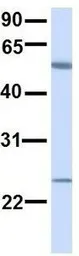 Anti-ALG6 antibody, N-term used in Western Blot (WB). GTX46386