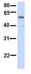 Anti-ALG6 antibody, N-term used in Western Blot (WB). GTX46386
