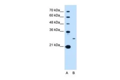 Anti-TSPAN15 antibody, C-term used in Western Blot (WB). GTX46388