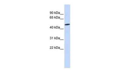 Anti-CSPG5 antibody, N-term used in Western Blot (WB). GTX46412