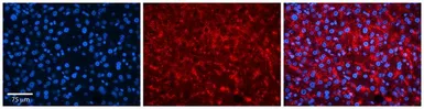 Anti-TSPAN31 antibody, Internal used in IHC (Paraffin sections) (IHC-P). GTX46417