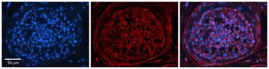 Anti-TSPAN3 antibody, Internal used in IHC (Paraffin sections) (IHC-P). GTX46420