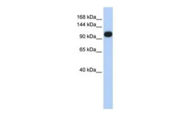 Anti-SERCA3 antibody, Internal used in Western Blot (WB). GTX46427