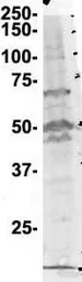 Anti-ERP72 antibody, N-term used in Western Blot (WB). GTX46431