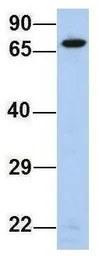 Anti-ERP72 antibody, Internal used in Western Blot (WB). GTX46432