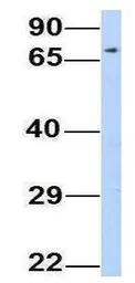 Anti-ERP72 antibody, Internal used in Western Blot (WB). GTX46432