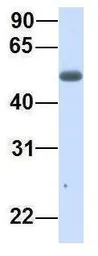 Anti-CHST2 antibody, Internal used in Western Blot (WB). GTX46441
