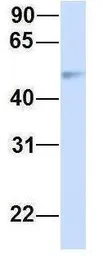 Anti-CHST2 antibody, Internal used in Western Blot (WB). GTX46441