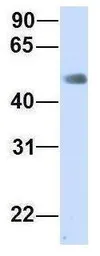 Anti-CHST2 antibody, Internal used in Western Blot (WB). GTX46441
