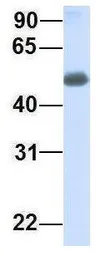 Anti-CHST2 antibody, Internal used in Western Blot (WB). GTX46441